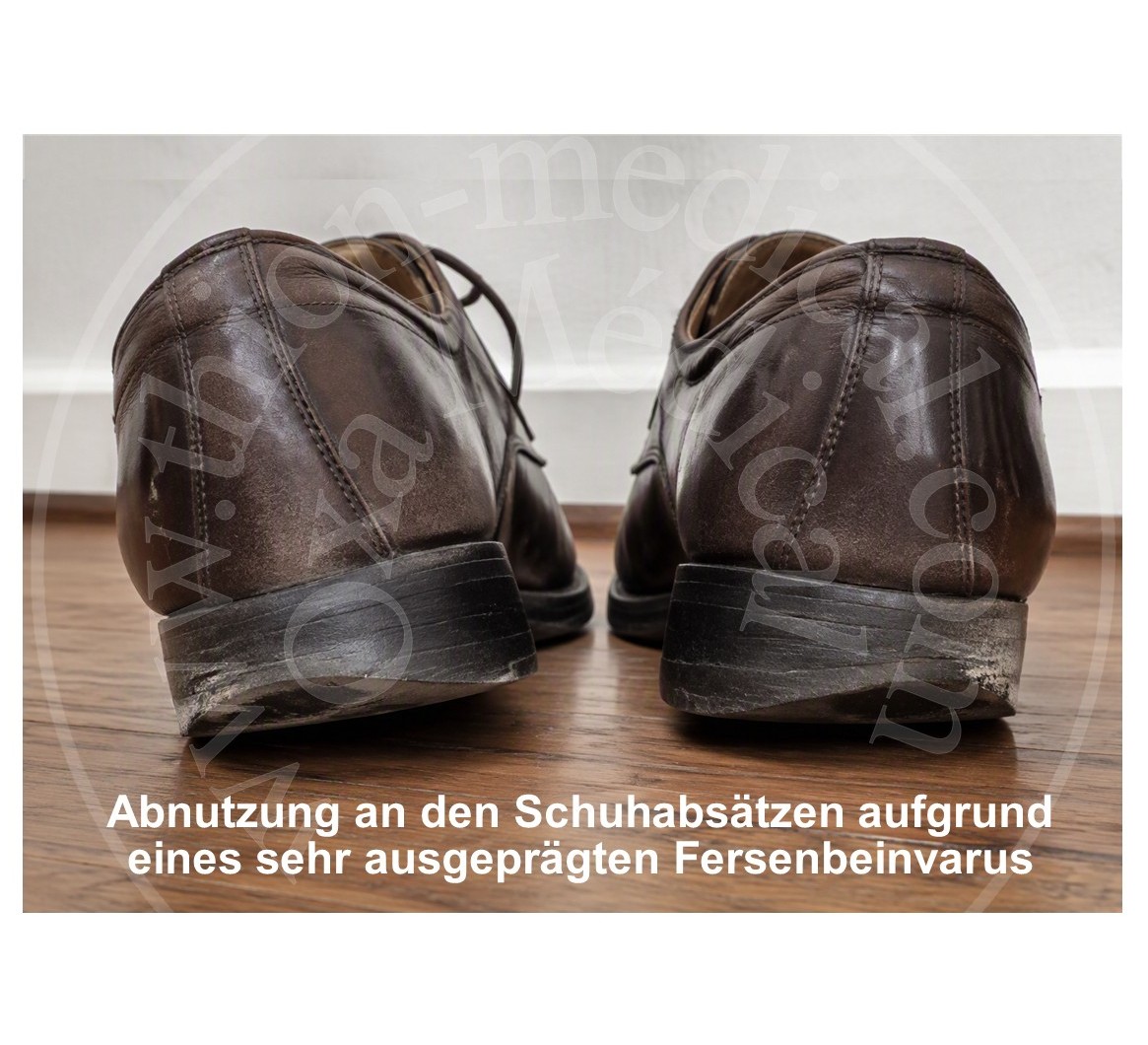 Foto von nach außen abgenutzten Schuhen